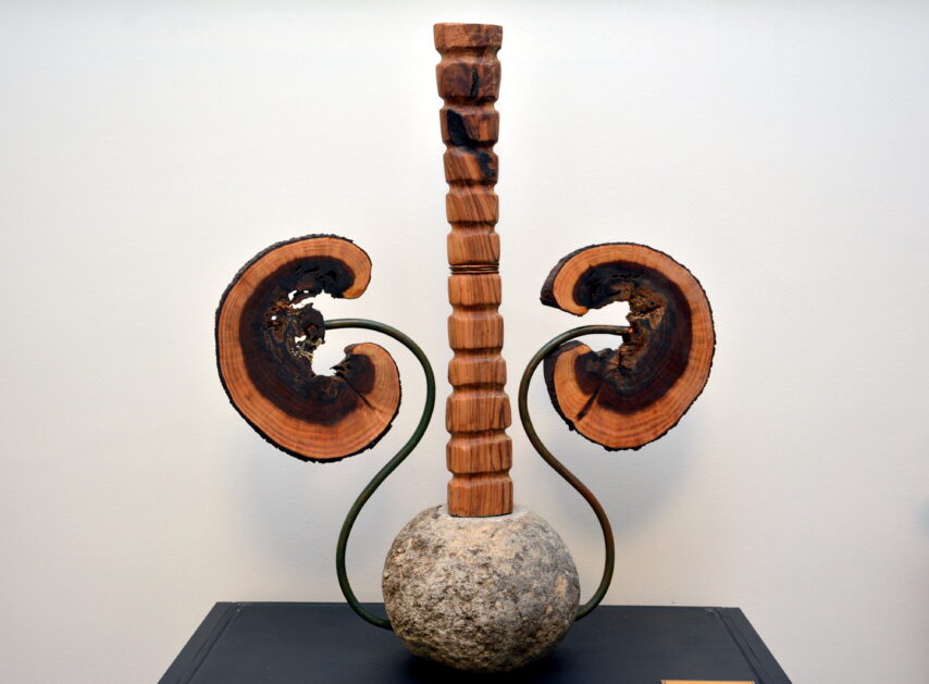 Kidney sculpture