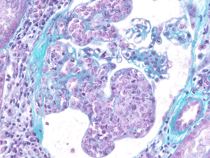 Glomerular capillary lumens