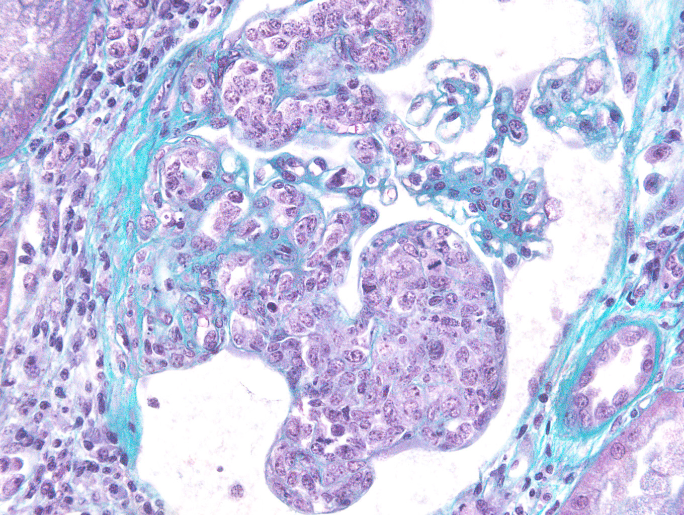 Glomerular capillary lumens