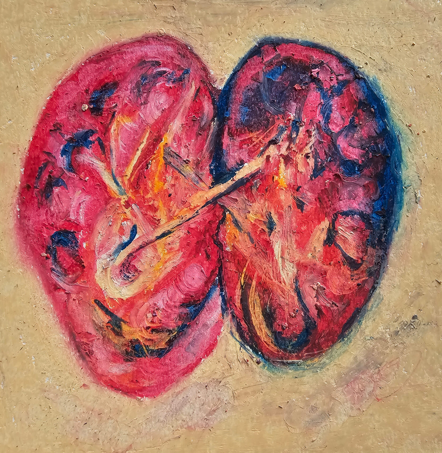 Gross Anatomy of Kidneys
